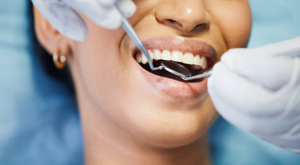 Best Emergency Broken Tooth Repair in Duquesne, MO